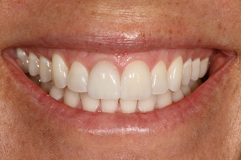 smile gallery image