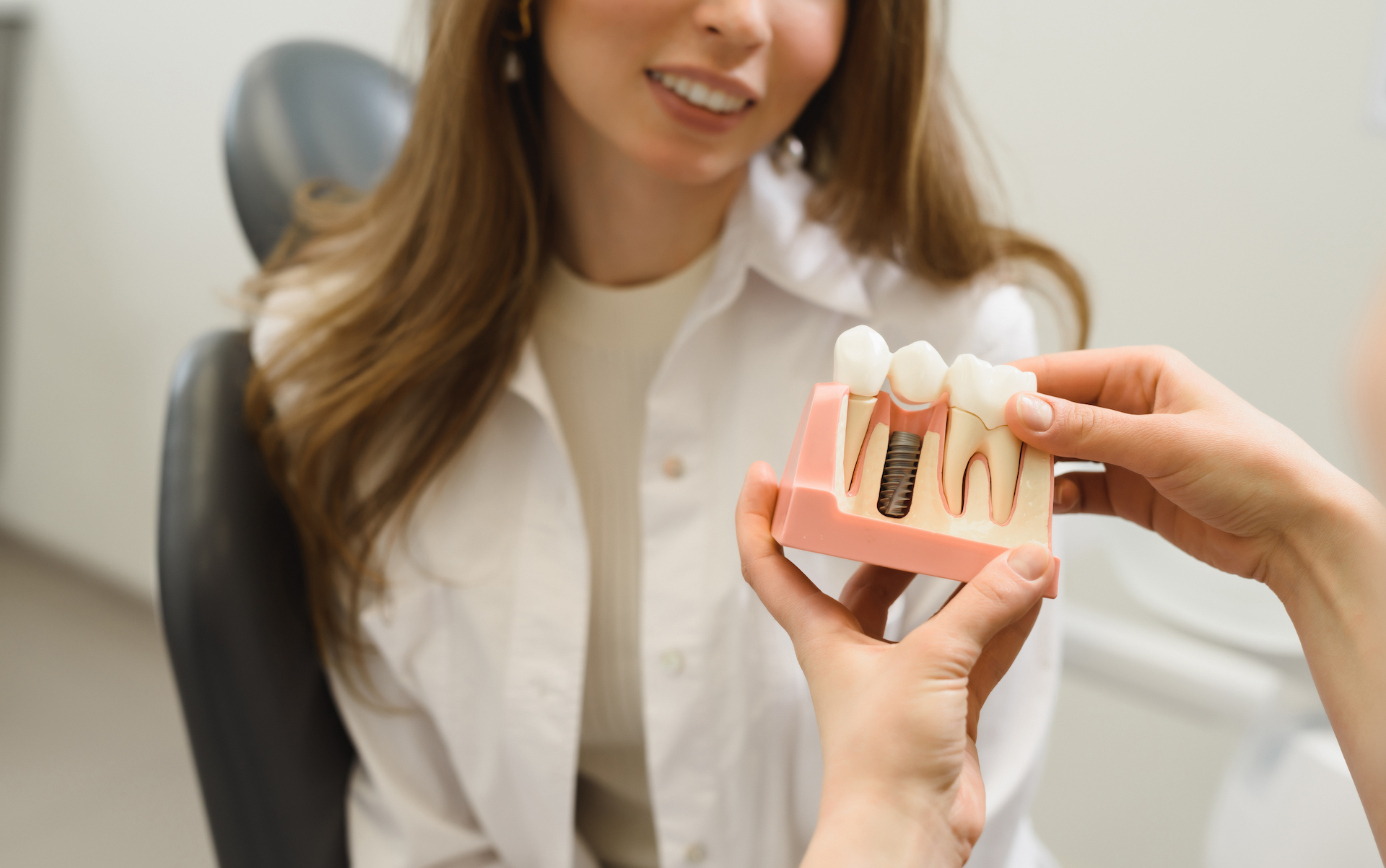 Cost vs. Value of Dental Implants