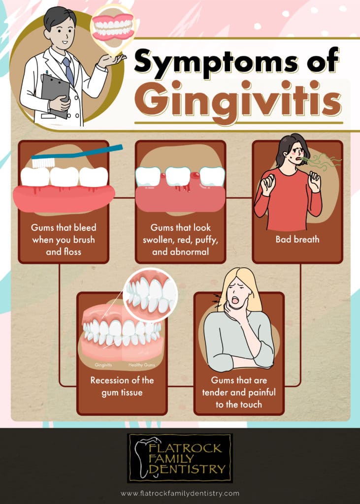 Symptoms of gingivitis